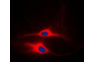 Immunofluorescent analysis of LCK staining in MCF7 cells. (LCK antibody  (Center))