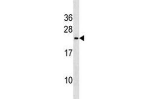 Trem2 antibody western blot analysis in mouse heart tissue lysate. (TREM2 antibody  (AA 22-48))