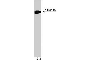Western blot analysis of SRPK2 on a A431 cell lysate (Human epithelial carcinoma, ATCC CRL-1555).