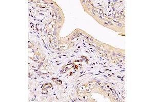 Immunohistochemistry of paraffin embedded rat bladder using MYL6 (ABIN7074734) at dilution of 1:650 (400x lens) (MYL6 antibody)