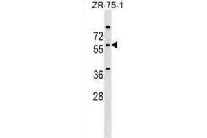 Western Blotting (WB) image for anti-Neuro-Oncological Ventral Antigen 2 (NOVA2) antibody (ABIN2999902)
