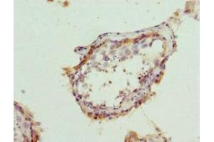 Immunohistochemistry of paraffin-embedded human testis tissue using ABIN7145177 at dilution of 1:100 (BCAP29 antibody  (AA 125-241))