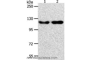 Western blot analysis of Hela and Jurkat cell, using ABL2 Polyclonal Antibody at dilution of 1:400 (ABL2 antibody)