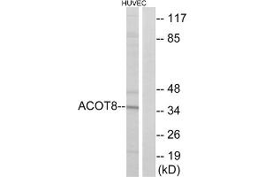Western blot analysis of extracts from HUVEC cells, using ACOT8 antibody.