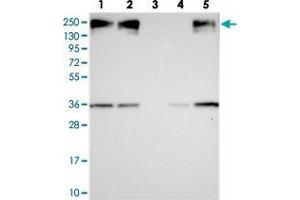 Western blot analysis of Lane 1: RT-4, Lane 2: U-251 MG, Lane 3: Human Plasma, Lane 4: Liver, Lane 5: Tonsil with ZC3H4 polyclonal antibody  at 1:250-1:500 dilution.