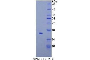 SDS-PAGE (SDS) image for CD160 (CD160) (AA 37-154) protein (His tag) (ABIN2124361)