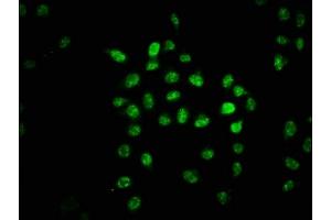 Immunofluorescence staining of Hela cells with ABIN7153409 at 1:67, counter-stained with DAPI.