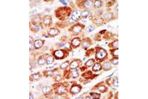 Image no. 2 for anti-Adenylate Kinase 1 (AK1) (C-Term) antibody (ABIN360679) (Adenylate Kinase 1 antibody  (C-Term))