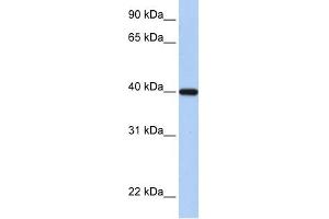 RDH11 antibody used at 1 ug/ml to detect target protein. (RDH11 antibody)