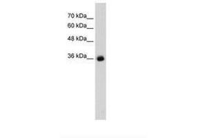 anti-gamma-aminobutyric Acid (GABA) A Receptor, gamma 2 (GABRG2) (AA 334-383) antibody