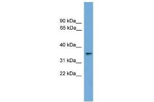 Western Blot showing RAD51L1 antibody used at a concentration of 1-2 ug/ml to detect its target protein. (RAD51 Homolog B antibody  (Middle Region))