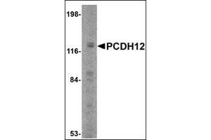 Western blot analysis of PCDH12 in K562 cell lysate with this product at 2 μg/ml.