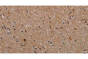 Immunohistochemistry of paraffin-embedded Human brain using NDUFA8 Polyclonal Antibody at dilution of 1:40 (NDUFA8 antibody)