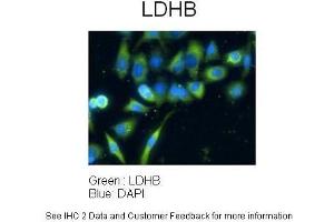 Immunohistochemistry (IHC) image for anti-Lactate Dehydrogenase B (LDHB) (C-Term) antibody (ABIN2783283)