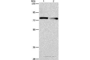 Western blot analysis of A549 and 231 cell, using NEK11 Polyclonal Antibody at dilution of 1:1000