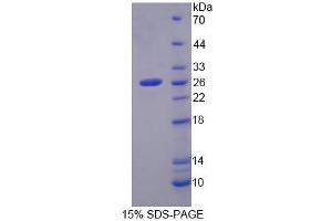 SDS-PAGE (SDS) image for Methylcrotonoyl-CoA Carboxylase 2 (Beta) (MCCC2) (AA 380-563) protein (His tag) (ABIN6239410)
