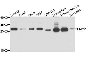 Western blot analysis of extracts of various cell lines, using PMM2 antibody. (PMM2 antibody)