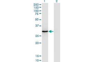 Western Blot analysis of ORC6L expression in transfected 293T cell line by ORC6L monoclonal antibody (M04), clone 3C4. (ORC6 antibody  (AA 1-252))