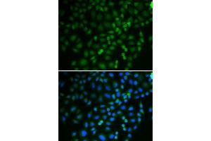 Immunofluorescence (IF) image for anti-Tripartite Motif Containing 21 (TRIM21) (AA 80-330) antibody (ABIN6219108) (TRIM21 antibody  (AA 80-330))