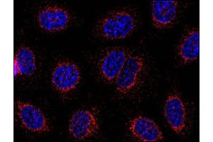 Immunofluorescence staining of HeLa human cervix carcinoma cell line using anti-STIM1 (CDN3H4 ; methanol-aceton fixation; detection by Goat anti-mouse IgG1 Alexa Fluor® 598; red). (STIM1 antibody  (C-Term))