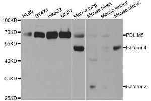 Western blot analysis of extracts of various cell lines, using PDLIM5 antibody. (PDLIM5 antibody  (AA 317-596))
