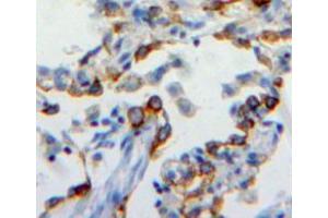 Used in DAB staining on fromalin fixed paraffin-embedded lung tissue (CEACAM6 antibody  (AA 35-142))