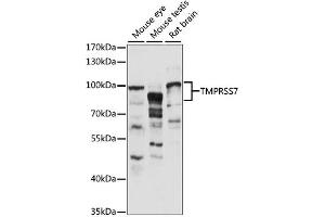 Western blot analysis of extracts of various cell lines, using TMPRSS7 antibody (ABIN6294019) at 1:1000 dilution. (TMPRSS7 antibody)