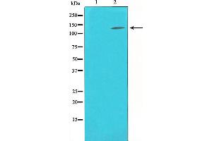 Western blot analysis of extracts from Hela, using Collagen III Antibody.