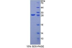 SDS-PAGE analysis of Human KEL Protein.
