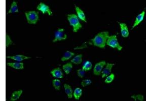 Immunofluorescence staining of SH-SY5Y cells with ABIN7140143 at 1:50, counter-stained with DAPI. (CD24 antibody  (AA 28-46))