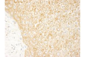 Immunohistochemistry (IHC) image for anti-Mitogen-Activated Protein Kinase Kinase Kinase MLT (ZAK) (AA 750-800) antibody (ABIN7448872) (ZAK antibody  (AA 750-800))