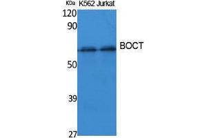 Western Blotting (WB) image for anti-Solute Carrier Family 22 (Organic Cation Transporter), Member 17 (SLC22A17) (Internal Region) antibody (ABIN3187626) (SLC22A17 antibody  (Internal Region))