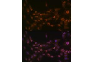 Immunofluorescence analysis of C6 cells using PRMT1 Rabbit mAb  at dilution of 1:100 (40x lens). (PRMT1 antibody)