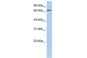 LSS antibody used at 1 ug/ml to detect target protein. (LSS antibody)