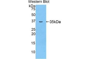 Detection of Recombinant aZGP1, Rat using Polyclonal Antibody to Alpha-2-Glycoprotein 1, Zinc Binding (aZGP1) (AZGP1 antibody  (AA 18-296))