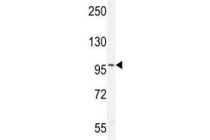 Western Blotting (WB) image for anti-Androgen Receptor (AR) (AA 365-392) antibody (ABIN3029940)