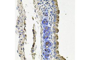 Immunohistochemistry of paraffin-embedded mouse lung using FLT1 antibody at dilution of 1:100 (x40 lens). (FLT1 antibody)