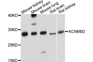 Western blot analysis of extracts of various cell lines, using KCNMB2 antibody. (KCNMB2 antibody)