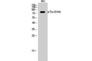Western Blotting (WB) image for anti-tau Protein (pSer396) antibody (ABIN3182162) (tau antibody  (pSer396))