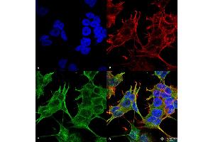 Immunocytochemistry/Immunofluorescence analysis using Mouse Anti-GluN2A/NR2A Monoclonal Antibody, Clone S327-95 . (NMDAR2A antibody  (AA 75-325) (Atto 488))