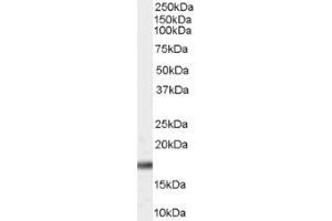 Image no. 1 for anti-Peptidylprolyl Cis/trans Isomerase, NIMA-Interacting 1 (PIN1) (Internal Region) antibody (ABIN374746)