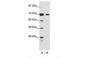Image no. 1 for anti-Tripartite Motif Containing 32 (TRIM32) (N-Term) antibody (ABIN202853) (TRIM32 antibody  (N-Term))