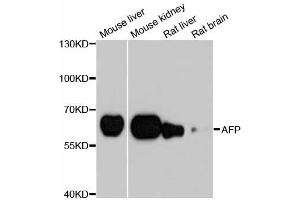 Western blot analysis of extracts of various cell lines, using AFP antibody.