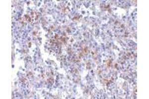 Immunohistochemistry of EVER1 in human spleen with EVER1 antibody at 2. (TMC6 antibody  (Center))