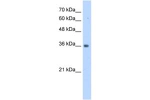 Western Blotting (WB) image for anti-TruB Pseudouridine (Psi) Synthase Homolog 2 (TRUB2) antibody (ABIN2463175) (TRUB2 antibody)