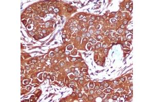 Immunohistochemistry (IHC) image for anti-Protein Kinase, AMP-Activated, beta 1 Non-Catalytic Subunit (PRKAB1) antibody (ABIN6241589)