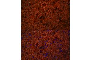 Immunofluorescence analysis of mouse brain using SN Rabbit pAb (ABIN3021231, ABIN3021232, ABIN3021233 and ABIN6214078) at dilution of 1:100 (40x lens). (SNAP25 antibody  (AA 1-206))