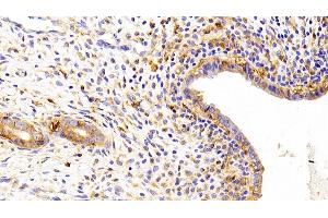 Detection of Kim1 in Rat Uterus Tissue using Polyclonal Antibody to Kidney Injury Molecule 1 (Kim1) (HAVCR1 antibody  (AA 22-235))