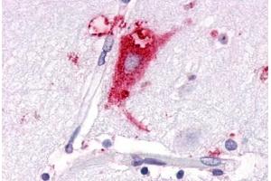 Anti-GPR63 antibody  ABIN1048855 IHC staining of human brain, neurons and glia.
