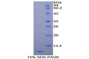 SDS-PAGE (SDS) image for serpin Peptidase Inhibitor, Clade B (Ovalbumin), Member 4 (SERPINB4) (AA 320-390) protein (His tag) (ABIN1080832)